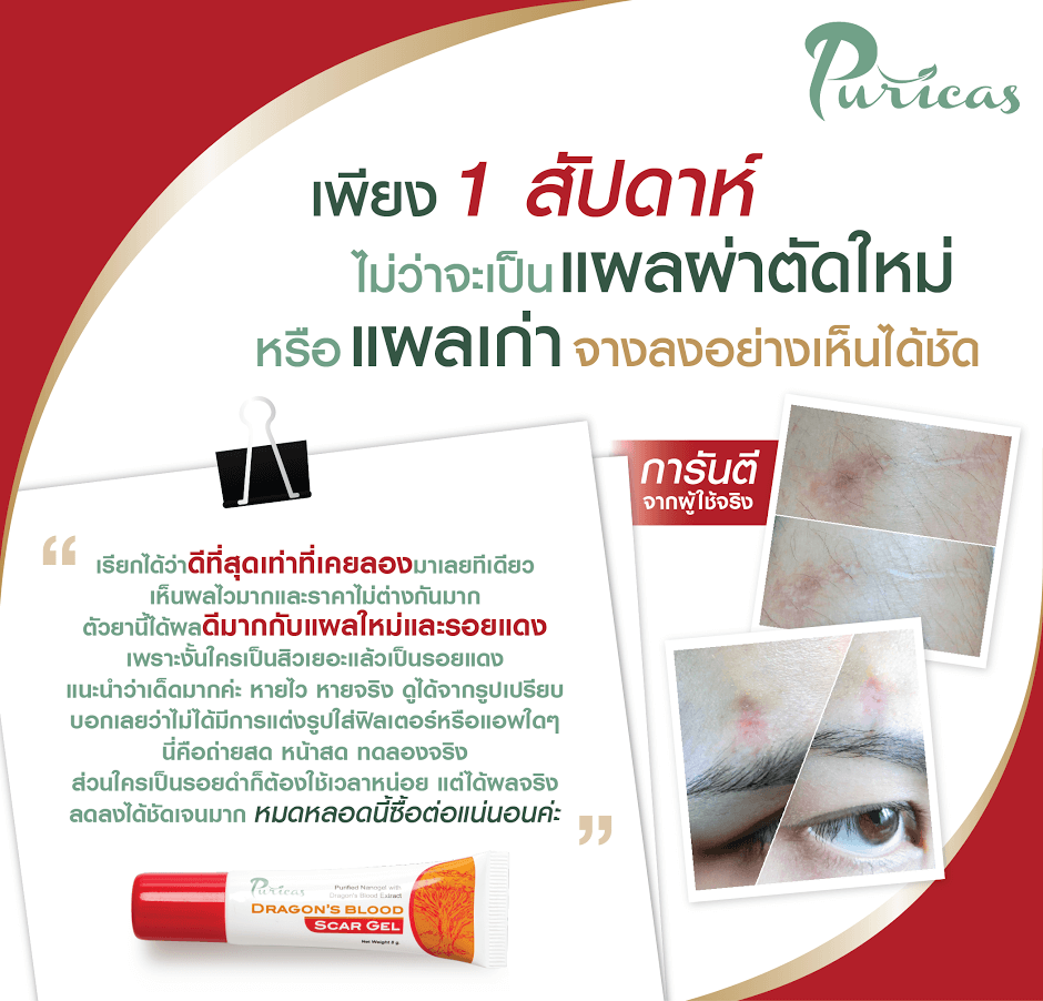 dragon blood scar gel, dragon blood scar gel pantip, dragon blood scar gel ขาย, dragon blood scar gel ซื้อที่ไหน ,dragon blood scar gel ราคา ,dragon blood scar gel รีวิว